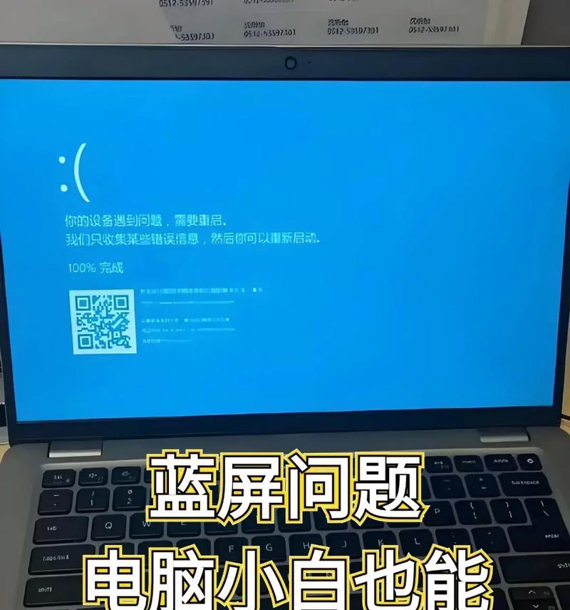 解决联想电脑蓝屏无法关机的问题（详解联想电脑蓝屏关机的原因和解决方法）